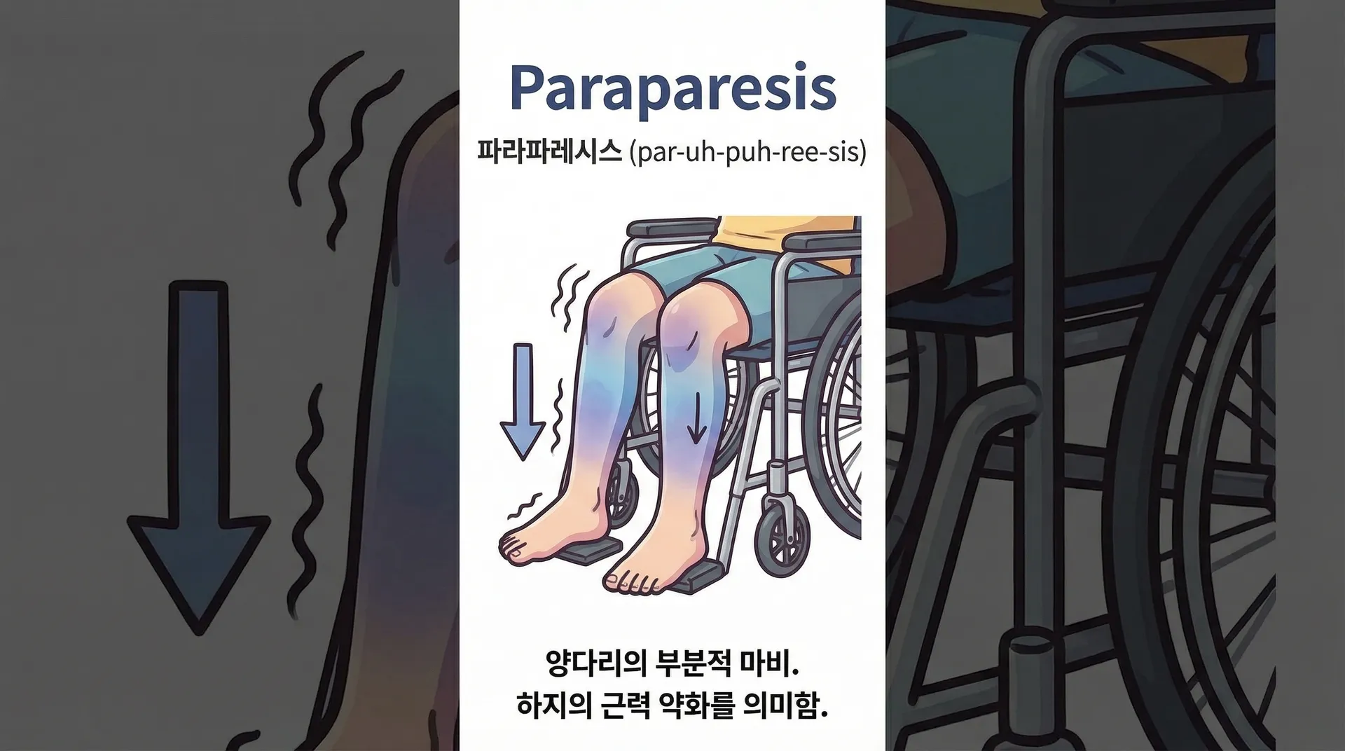 paraparesis 의학용어 뜻